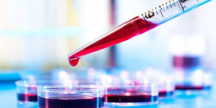A fost lansată testarea de screening la hepatitele virale B și C cu Teste Rapide de Diagnostic