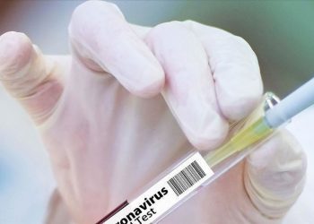 Ministrul Sănătății: În curând, în R. Moldova, se vor efectua nu mai puțin de 5.000 de teste pe zi la COVID-19