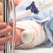 Căușeni: O fetiță de 3 anișori a suportat arsuri în timp ce bunica conserva pentru iarnă