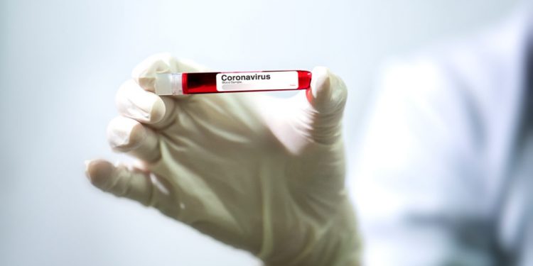 R. Moldova, din nou pe primul loc în Europa la numărul de infectări și decese provocate de COVID-19 | VIDEO