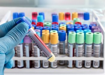 Продлен срок применения ряда мер по контролю инфекции COVID-19