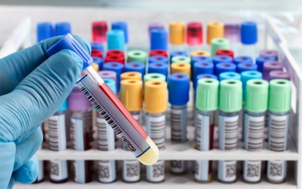 Продлен срок применения ряда мер по контролю инфекции COVID-19