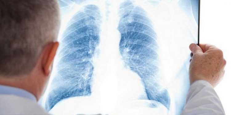 Продлен срок применения ряда мер по контролю инфекции COVID-19