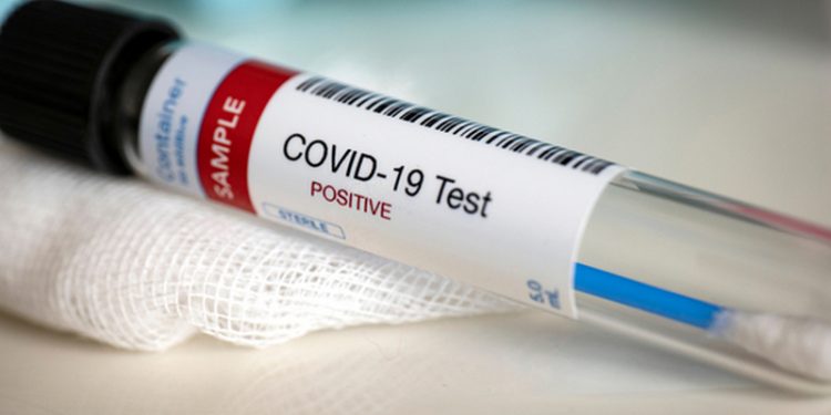 Продлен срок применения ряда мер по контролю инфекции COVID-19