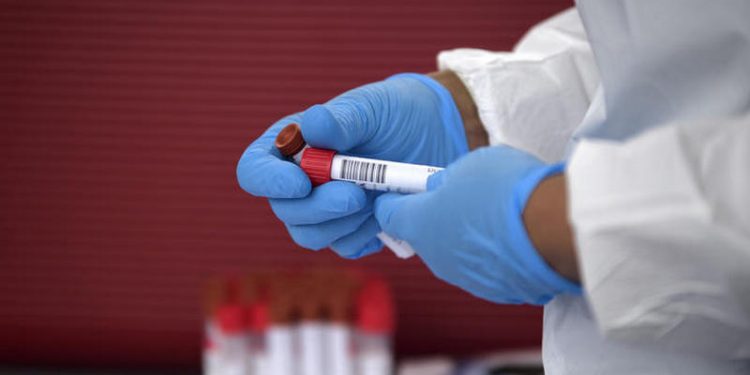 Продлен срок применения ряда мер по контролю инфекции COVID-19