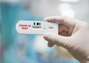 Dumbrăveanu: Republica Moldova urmează să cumpere teste rapide pentru depistarea COVID-19