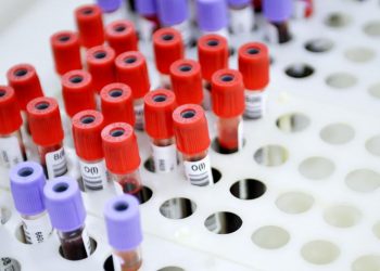 В Европе появился новый опасный вирус: зафиксирован первый случай инфицирования хантавирусом