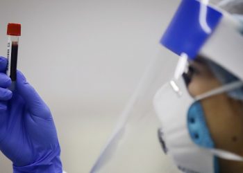 COVID-19: Ещё 915 случаев инфицирования вирусом и 18 умерших зарегистрирован за последние сутки на территории Молдовы | VIDEO