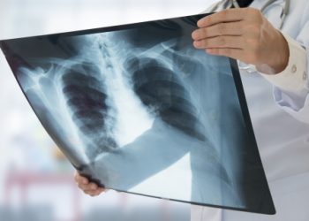 Bolnavii de tuberculoză din Moldova trec prin momente grele: Sunt depistați prea târziu, se închid în case sau se tratează online | VIDEO