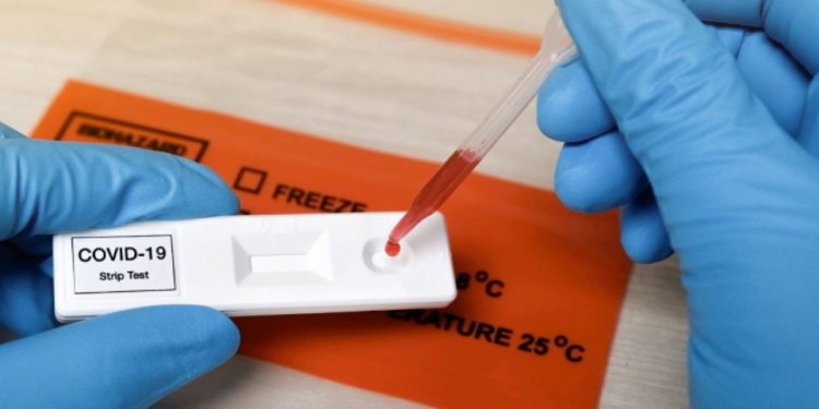 Agenția Medicamentului a aprobat câteva tipuri de teste rapide pentru depistarea noului coronavirus pe bază de antigen | VIDEO