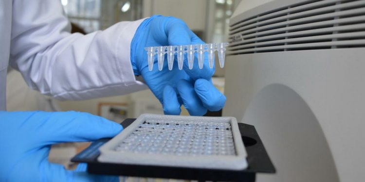 Ministerul Sănătății își suplinește rezervele: Încă 100 de mii de teste pentru depistarea noului coronavirus, procurate | VIDEO