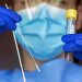 Moldova a primit din Rusia un lot de teste pentru depistarea infecţiei COVID-19