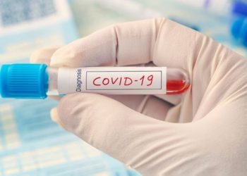 R. Moldova se pregătește să procure, în perioada următoare, 600 de mii de teste, dintre care 300 de mii – rapide, pentru depistarea COVID-19