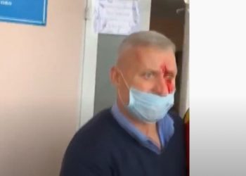 Примара села Кирсосово избили на рабочем месте. Узнай детали инцидента | VIDEO