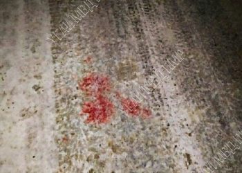 O minoră de 15 ani, transportată la spital cu multiple traume în urma unui accident | FOTO