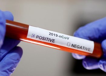 Теперь в Молдове можно сделать бесплатно экспресс-тест на COVID. Что для этого нужно