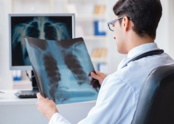 Forfota mare la radiografie: Mai mulți pacienți ajung să facă investigații pulmonare la clinicile private | VIDEO