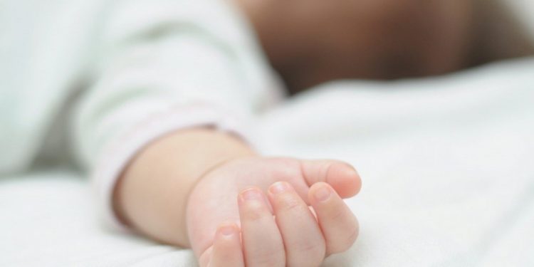 Ребенок с зафиксированной впервые в истории уникальной аномалией родился в Ираке