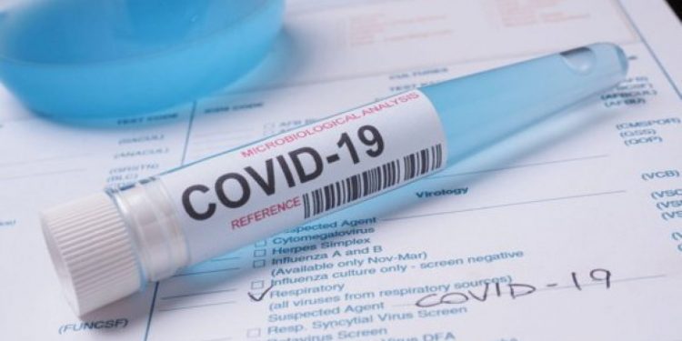 COVID-19: Încă 910 moldoveni au fost infectați, iar 32 au decedat, printre care și un medic | VIDEO