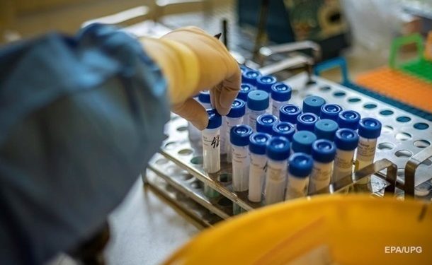 Сотрудница института биотехнологий в Киеве похитила опасные штаммы вируса
