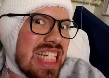 Мужчина лишился части мозга, чтобы не бояться смерти