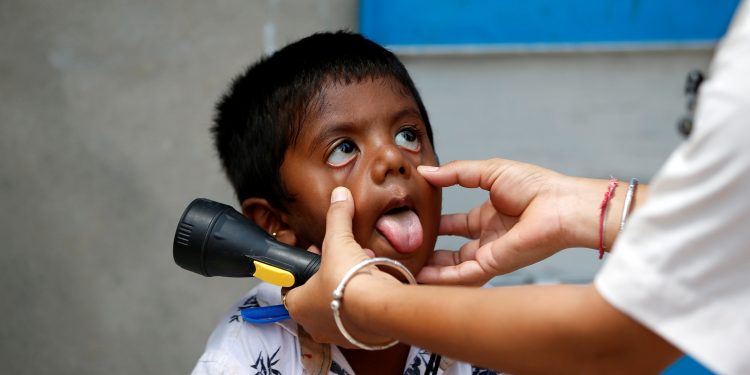 O afecțiune rară, dar gravă afectează copiii și adolescenții din India, vindecați de Covid