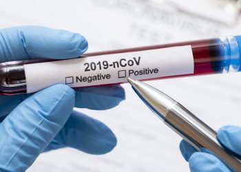 Numărul infectaților cu COVID-19 în capitală continuă să crească. Chișinăul ar putea reveni sub Cod Galben de restricții | VIDEO