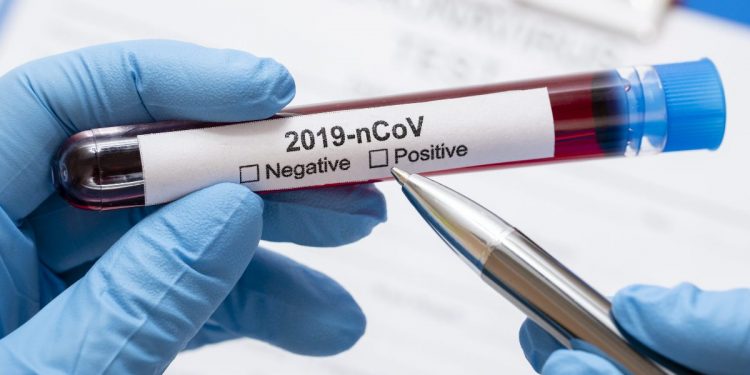 Numărul infectaților cu COVID-19 în capitală continuă să crească. Chișinăul ar putea reveni sub Cod Galben de restricții | VIDEO