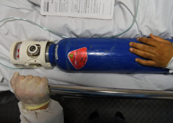 Причиной гибели 9 пациентов во Владикавказе стал прорыв подземной трубы с кислородом