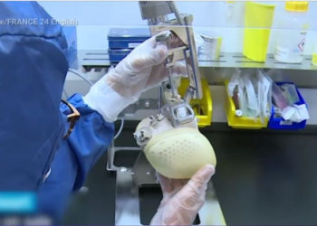 A fost construită prima inimă artificială. Cântărește aproape 1 kg și a salvat viața unui bărbat de 39 de ani | VIDEO