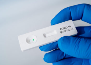 România trimite către Republica Moldova 100.000 de teste rapide antigen COVID-19