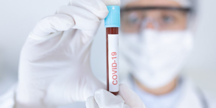 Comisia Europeană a semnat un contract de achiziție pentru un tratament cu anticorpi monoclonali pentru pacienții cu COVID-19