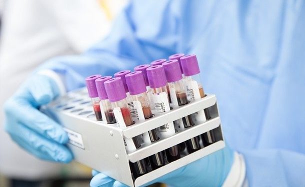 Названа длительность иммунитета у переболевших COVID