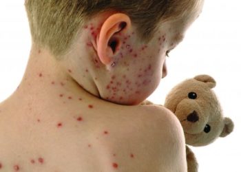 ВОЗ предупреждает о вспышке кори
