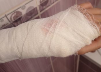 Care este starea minorului de 11 ani, care s-a electrocutat după ce a pătruns în instalația electrică de pe teritoriul liceului unde învață | VIDEO