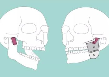 В теле человека нашли новую мышцу