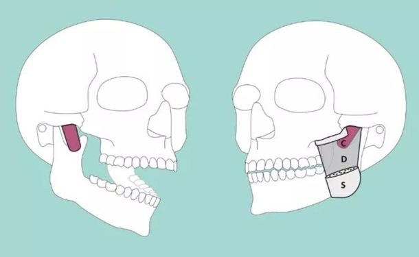 В теле человека нашли новую мышцу