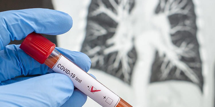 Продолжительность карантина при контактах с пациентами с COVID-19 была снижена