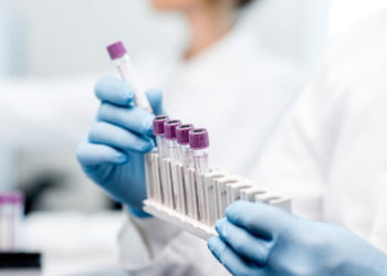 Lista statelor pentru care se solicită prezentarea rezultatului negativ al unui test RT-PCR la intrarea în Moldova