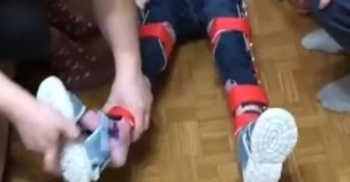 5-летняя девочка перестала ходить после COVID-19