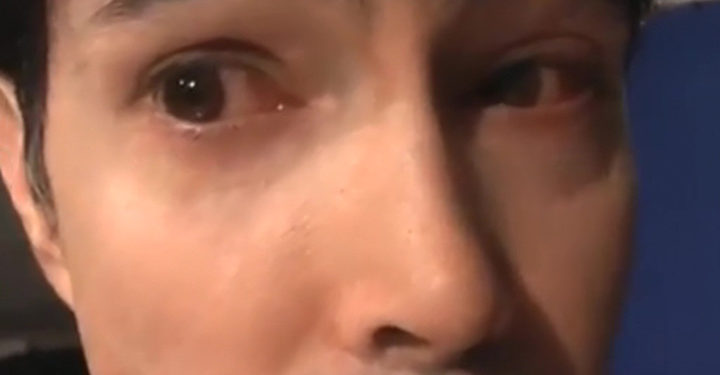 Ковид атакует глаза: симптомы