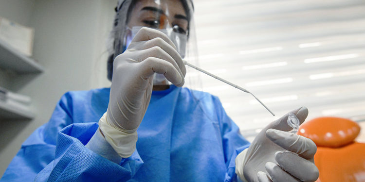 La Chișinău va fi deschis un laborator municipal de testare PCR. Detalii de la autorități