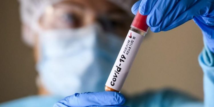 Уровень заболеваемости Covid-19 вырос более чем на 53% относительно прошлой недели