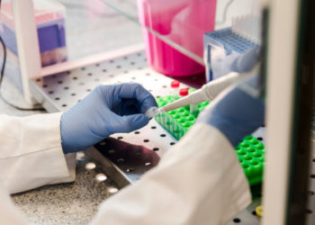 COVID: În Moldova au fost înregistrate încă 3 927 cazuri noi de infectare