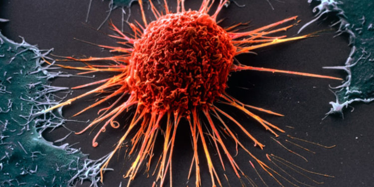 Pacienți cu cancer limfatic vindecați cu ajutorul virusului HIV. Cum acționează tratamentul