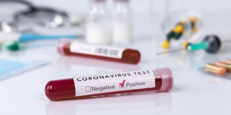 Noua Zeelandă înregistrează peste un milion de cazuri de COVID, după ce a trecut pandemia aproape fără virus