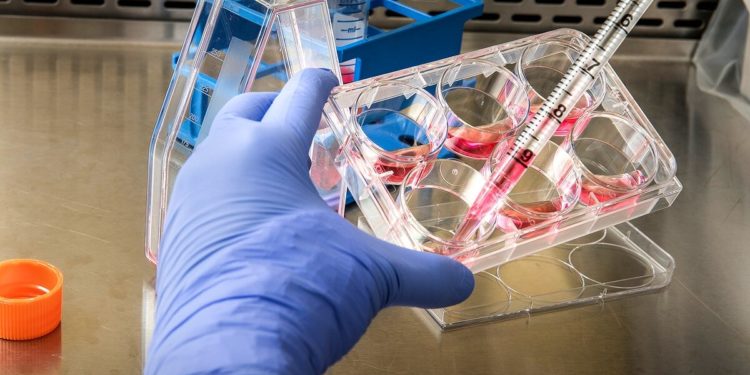 Власти США начали обсуждать вопрос признания оспы обезьян ЧС в здравоохранении