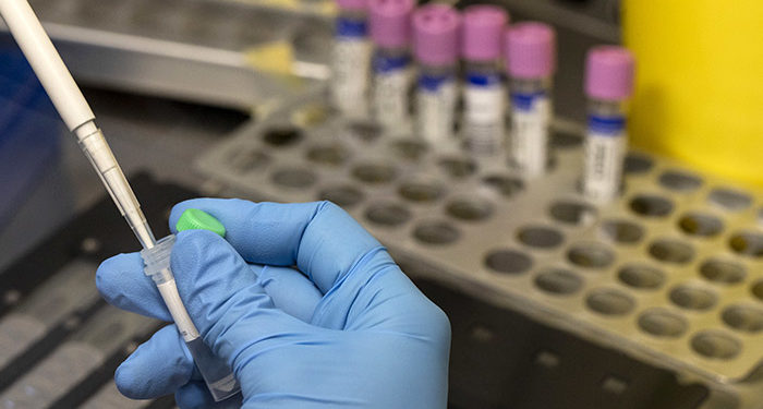 В России выявлена оспа обезьян