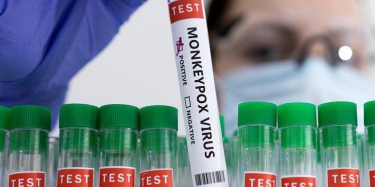 В Европе впервые зафиксировали смерть от оспы обезьян