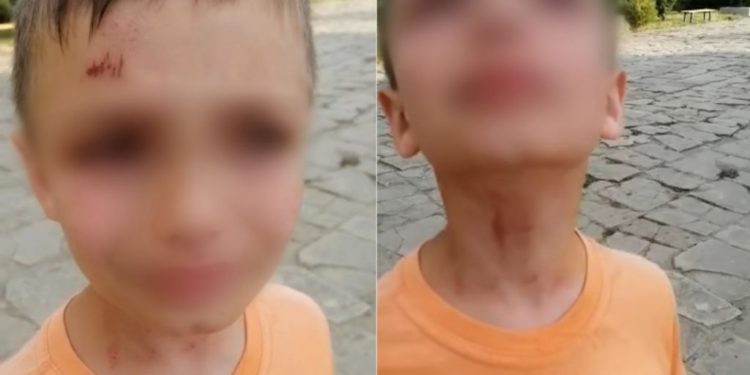 Doi copii au fost bătuți de un polițist de frontieră, la Basarabeasca